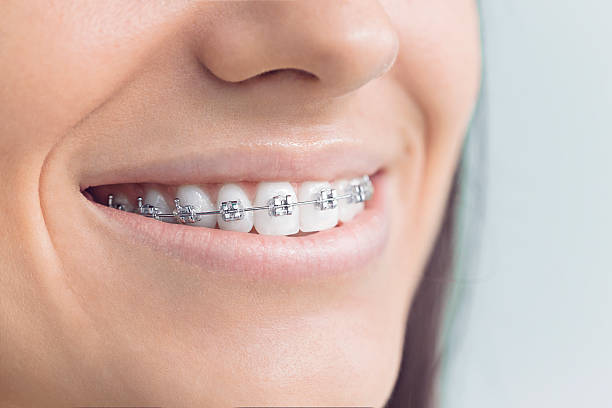 Why Choose Us for Your Dental Needs in West Cape May, NJ